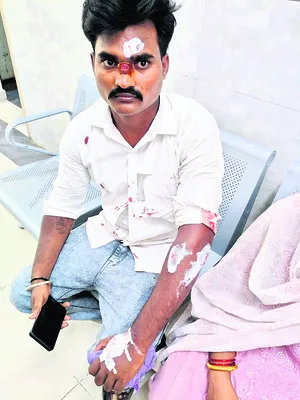 రోడ్డ