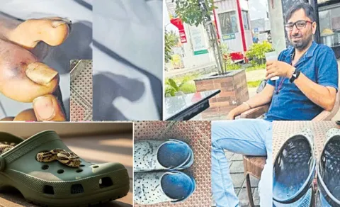 Engineer Dies After Snake Bite Hidden in Footwea