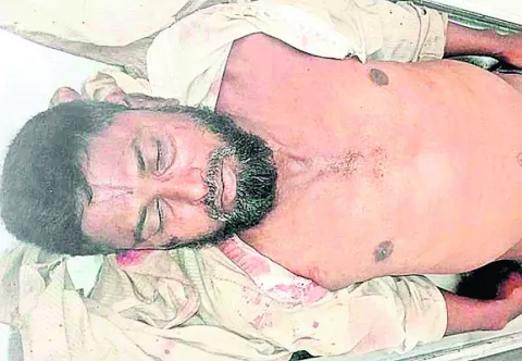 చిత్తూరులో వ్యక్తి ఆత్మహత్య 
