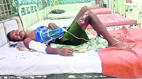 విద్యుత్‌ వైర్లు తగిలి వ్యక్తికి తీవ్రగాయాలు 