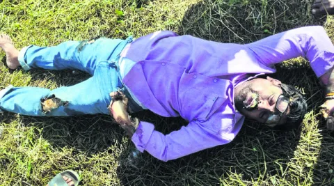 లైన్‌మెన్‌కు విద్యుత్‌ షాక్‌