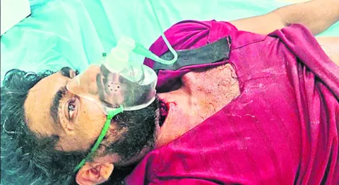 అండర్