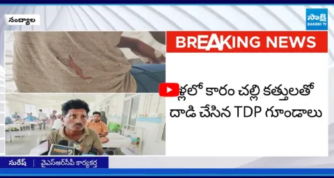 TDP Goons ATTACK on YSRCP Activist Suresh at Nandyala 3