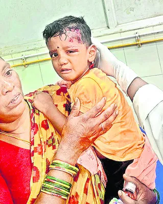 వీధికుక్క దాడిలో బాలుడికి తీవ్ర గాయాలు