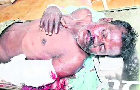 రైలు నుంచి జారిపడి వ్యక్తికి తీవ్ర గాయాలు