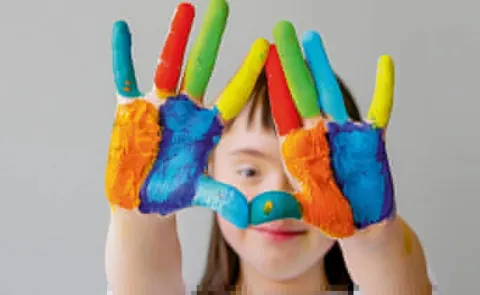 down syndrome symptoms and precautions
