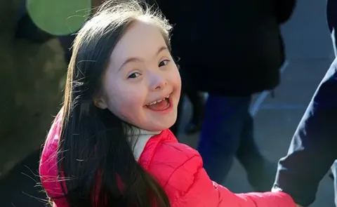 Types of Downs Syndrome and Treatment