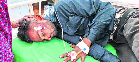 వేర్వేరు రోడ్డుప్రమాదాల్లో ముగ్గురికి గాయాలు