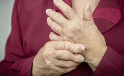 Rheumatoid arthritis early detection is important