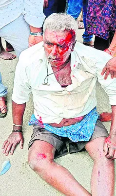 బైక్‌ను ఢీకొట్టిన కారు 
