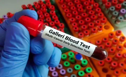 Grail says new data on multi-cancer screening test show