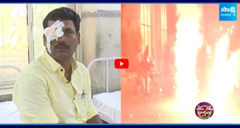 Firecracker eye injuries during Deepavali festival 2