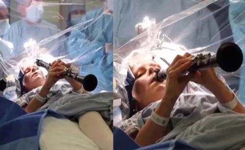 woman with Parkinsons disease plays clarinet during brain surgery 8