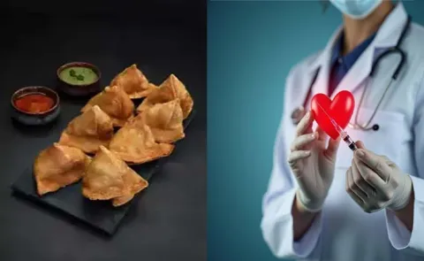 Rs 20 samosa vs Rs 3 lakh angioplasty: Delhi heart doctors blunt warning10