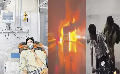 Kurnool Bus Accident Victim Recover At Hospital