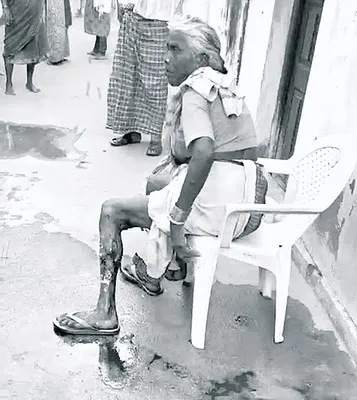 కుక్కదాడిలో వృద్ధురాలికి   తీవ్ర గాయాలు