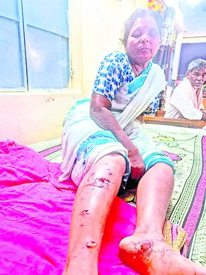 రైతులపై అడవి జంతువు దాడి