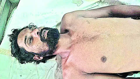 పడవ బోల్తాపడి మత్స్యకారుడి మృతి 