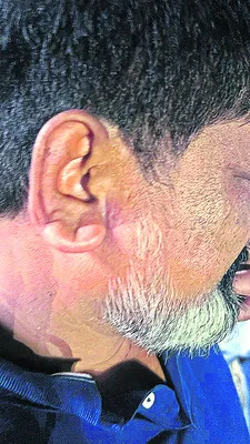 జిల్ల