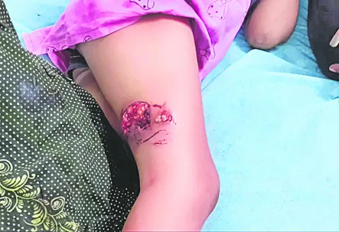20 వరకూ ఇగ్నో పరీక్ష గడువు పెంపు  