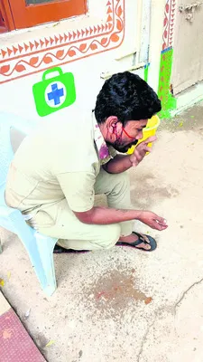 ఓపెన్
