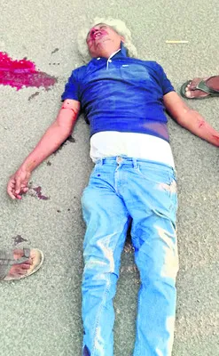 మినీ లారీ ఢీకొని ఒకరికి గాయాలు