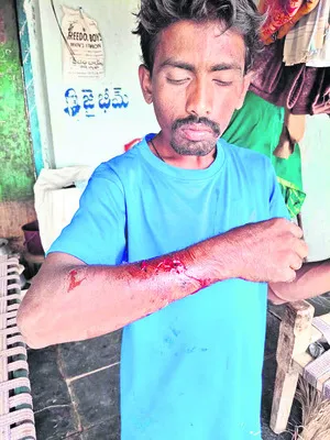 పిచ్చికుక్క దాడిలోఐదుగురికి గాయాలు 
