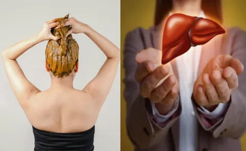 Do you know Henna dye reverse liver damage new study 