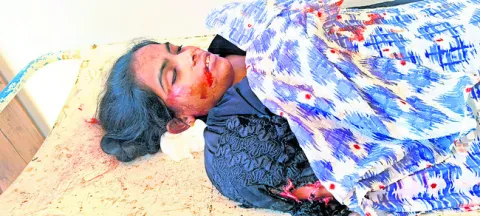 ● మహిళా మృతి 
