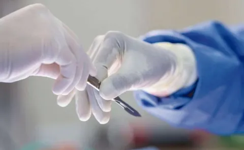 Negligence in medical services in government hospitals