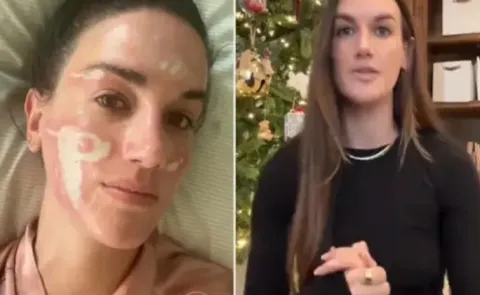 Priyanka Chopra Facialist Sued For 31 Lakh By Woman for Chemical Peel treatment