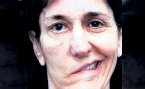 Increasing cases of facial paralysis in Winter