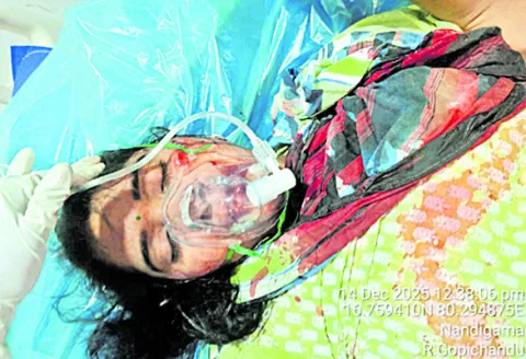 కారు, బైక్‌ ఢీ : ఇద్దరికి గాయాలు 