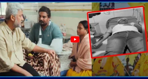 TDP Activists Attack On Two Innocents Who Met With Vallabhaneni Vamshi 3