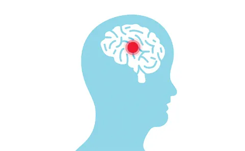 A precise marker for brain damage