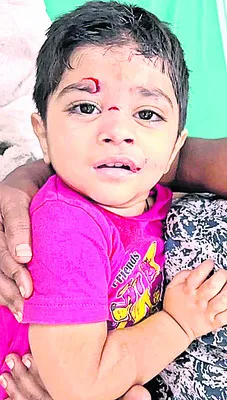 చిన్నారిపై కుక్క దాడి 
