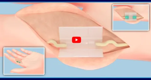 Can Damaged Nerves Be Repaired Here Is The Latest Breakthrough 1