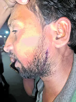 వైఎస్సార్‌ సీపీ బూత్‌ కన్వీనర్‌పై టీడీపీ కార్యకర్త దాడి