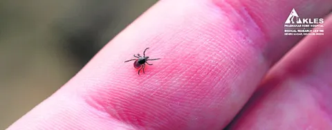 ఈ జాగ్రత్తలు మేలు 
