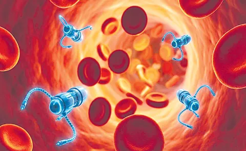 Scientists create microscopic robots that navigate blood vessels to treat strokes