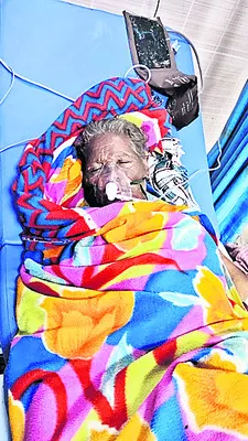 చలిమంట కాస్తుండగా నిప్పంటుకుని వృద్ధురాలికి గాయాలు 