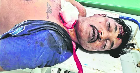 ఆగిఉన్న లారీని ఢీకొన్న బైక్‌ 