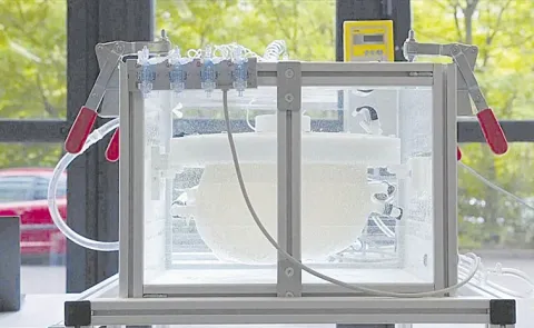 Scientists develop artificial womb to sustain premature babies