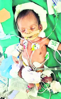 ప్రాణాంతక వ్యాధితో చిన్నారి పోరాటం.. 