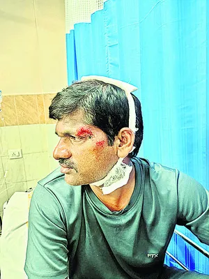 వైఎస్సార్‌ సీపీ అభిమానిపై దాడి 