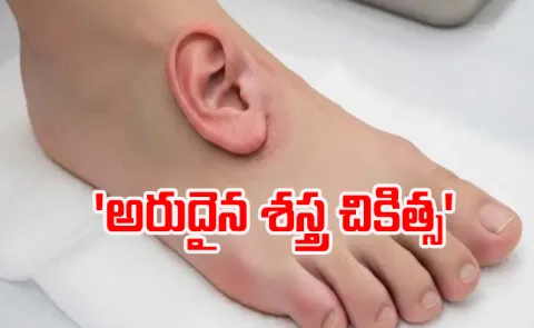 How Chinese doctors kept a severed ear alive reattached it months later