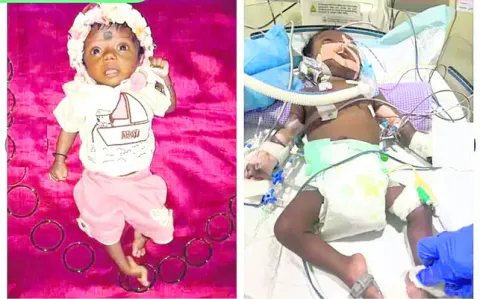 పసిబిడ్డకు ప్రాణం పోయండి