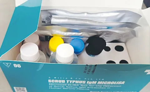 Scrub typhus tests conducted with outdated kits at Kakinada GGH