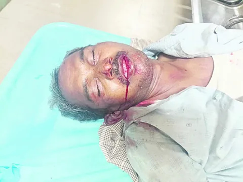 ఉపాధి ఫీల్డ్‌ అసిస్టెంట్‌కు తీవ్రగాయాలు