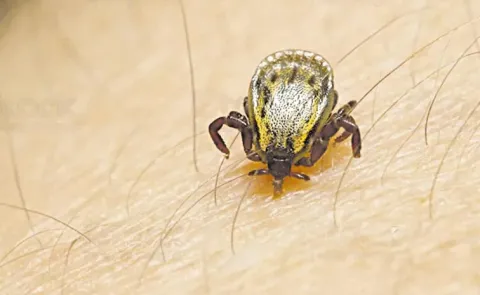 Scrub typhus cases rise in AP